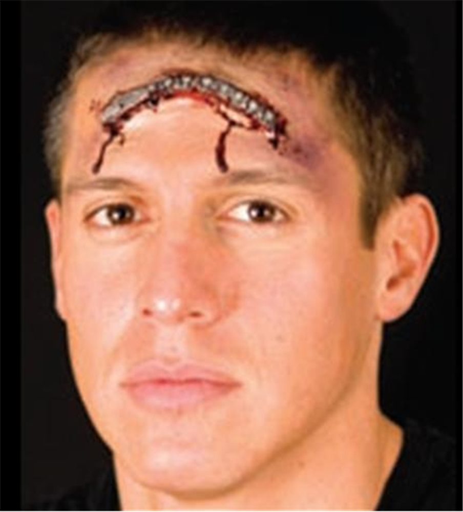 Picture of Woochie Zip It Prosthetic