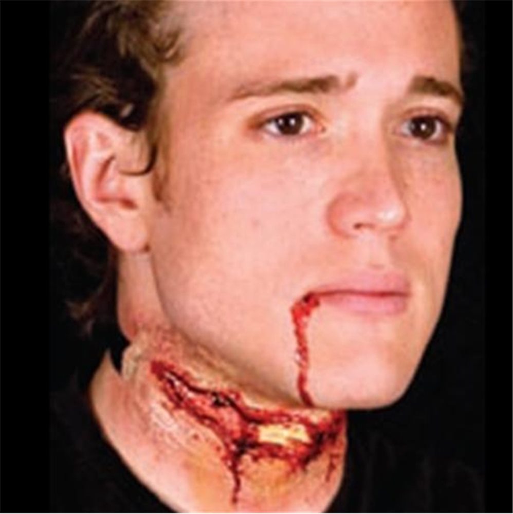 Picture of Woochie Slashed Neck Wound Appliance