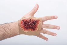 Picture of Acid Burn Hand Sleeve